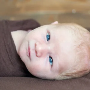 Falso estrabismo:  O que é isso?