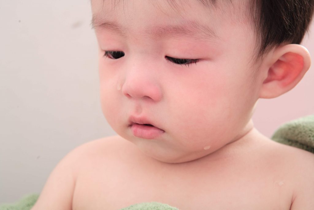 Obstrução de Via Lacrimal Congênita