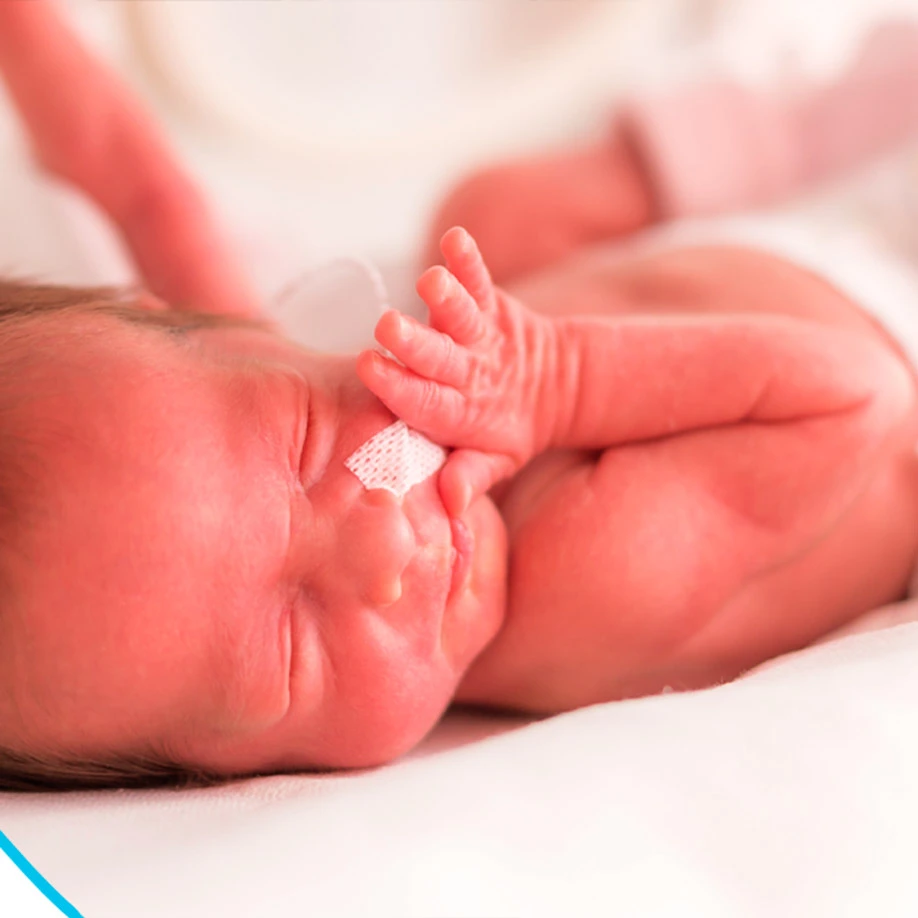 Retinopatia da Prematuridade